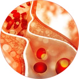 Cholesterol (Fat in Blood)
